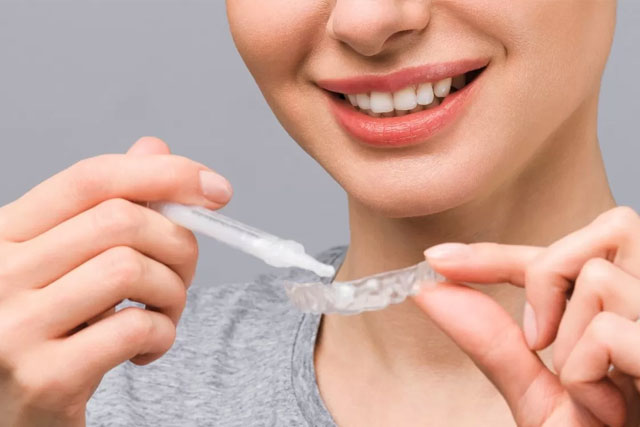 At-Home-Whitening-Kits