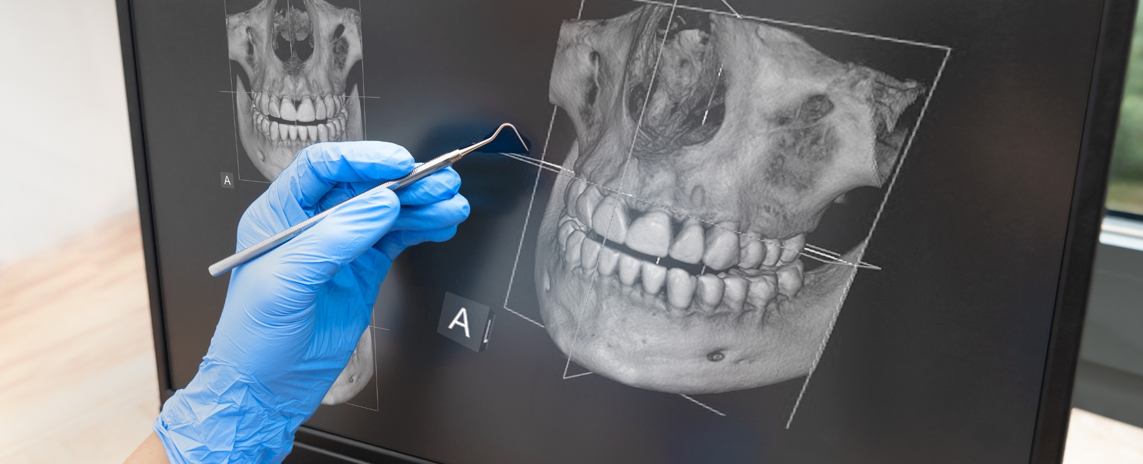 High resolution 3D imaging